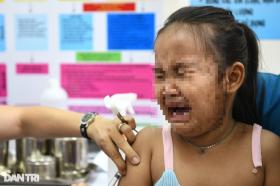 TPHCM chuẩn bị hơn 300.000 liều vaccine sởi cho trẻ em